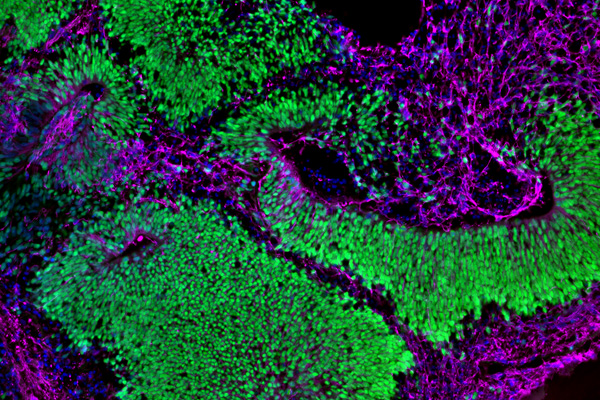 美国国立卫生研究院（NIH）设立美国首个标准化类器官建模中心