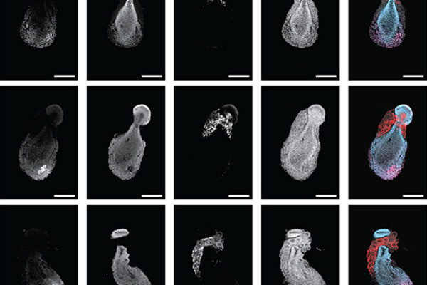 类器官研究新突破：对称性破缺机制揭示胚胎发育奥秘